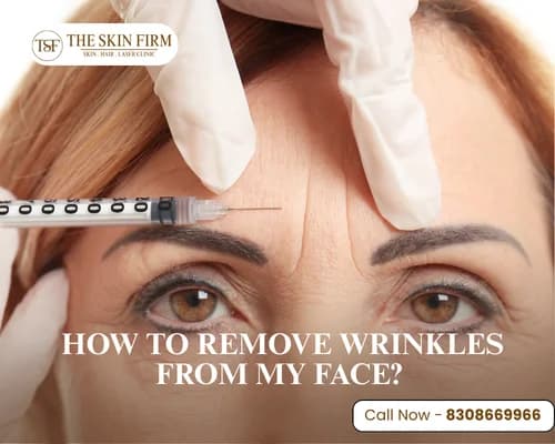 How to Remove Wrinkles from My Face.