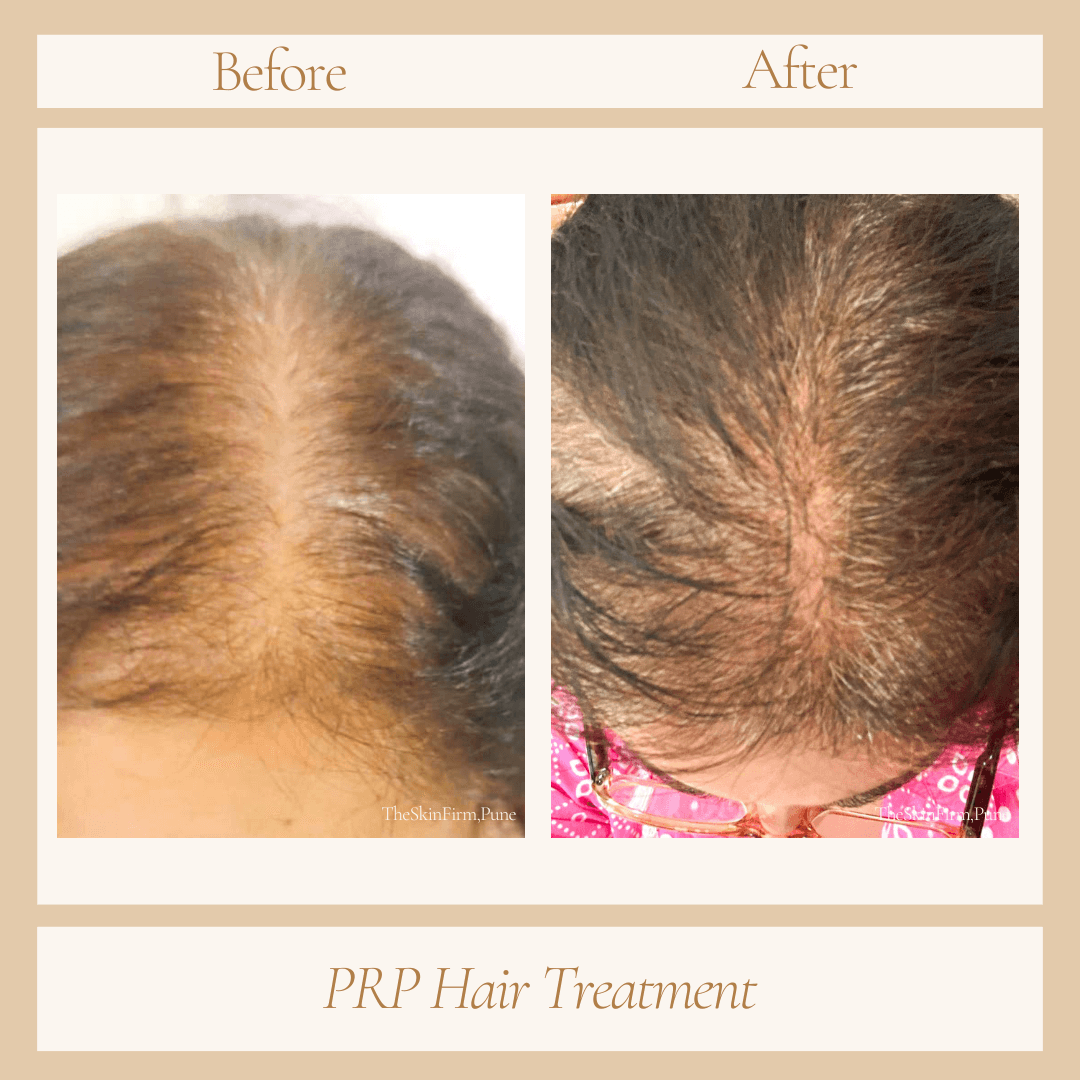 Before and After Transformation 5