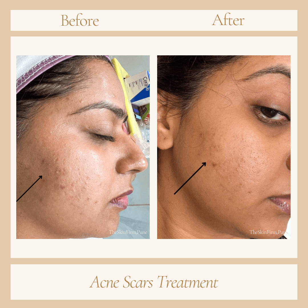 Before and After Transformation 1