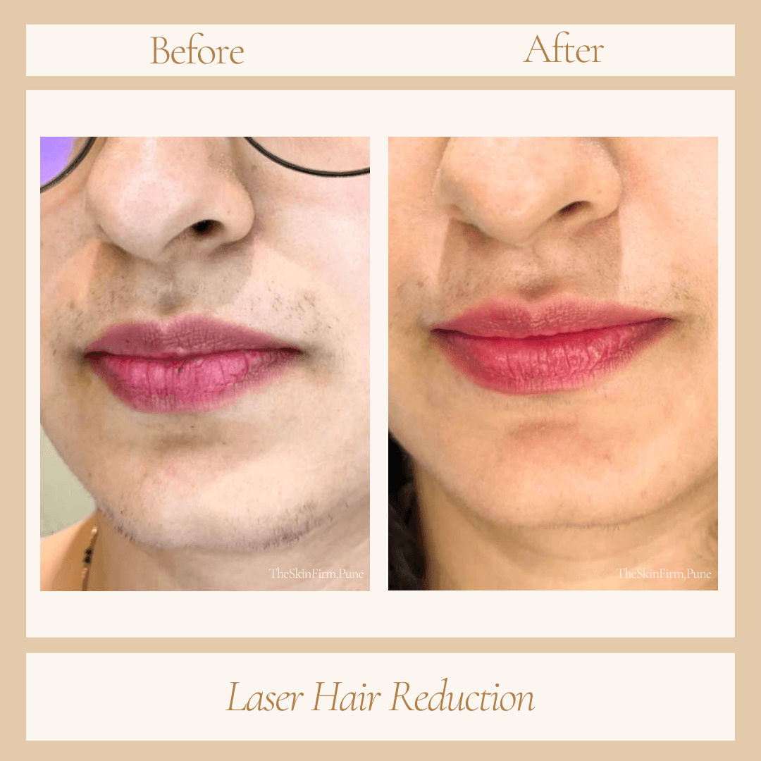 Before and After Transformation 6