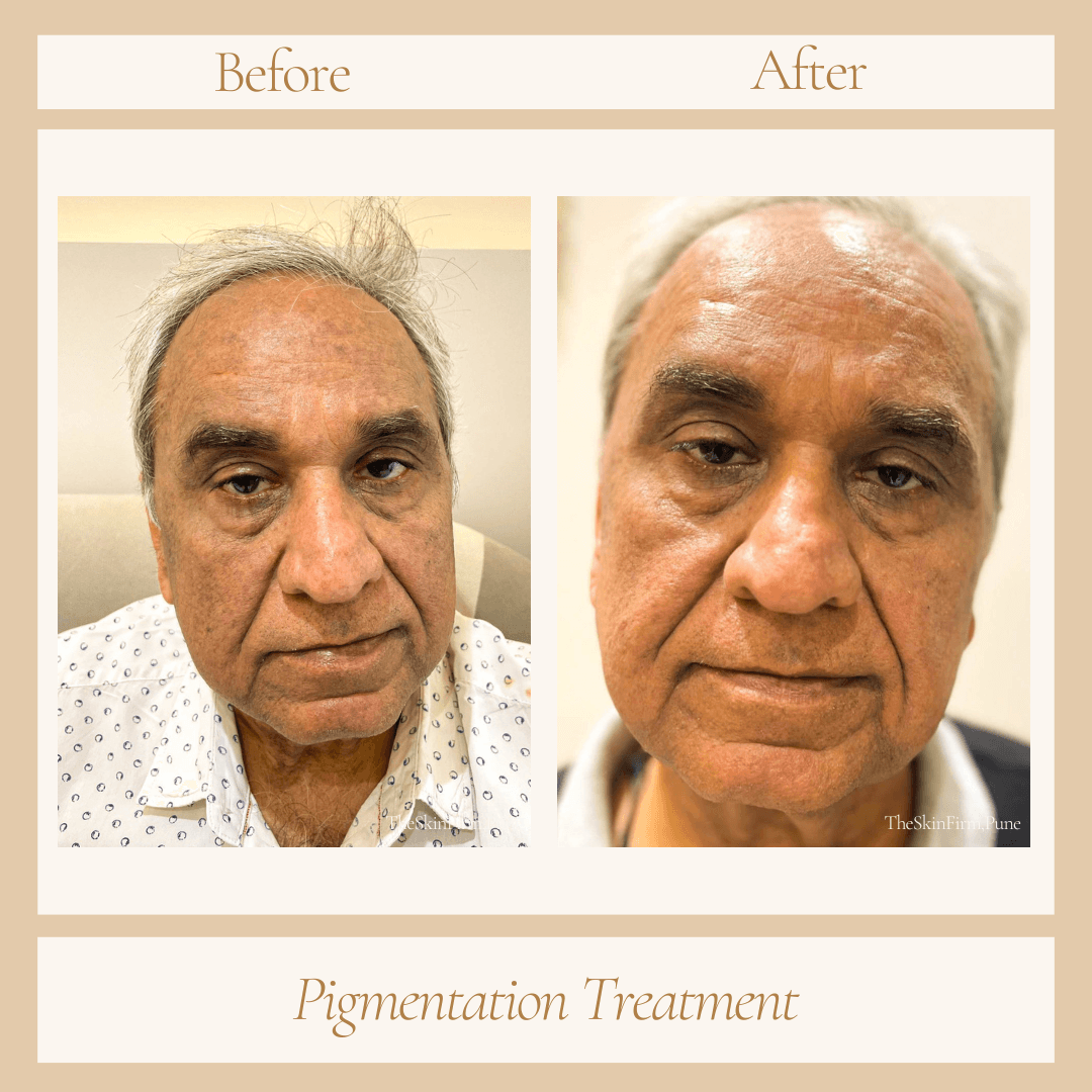 Before and After Transformation 2