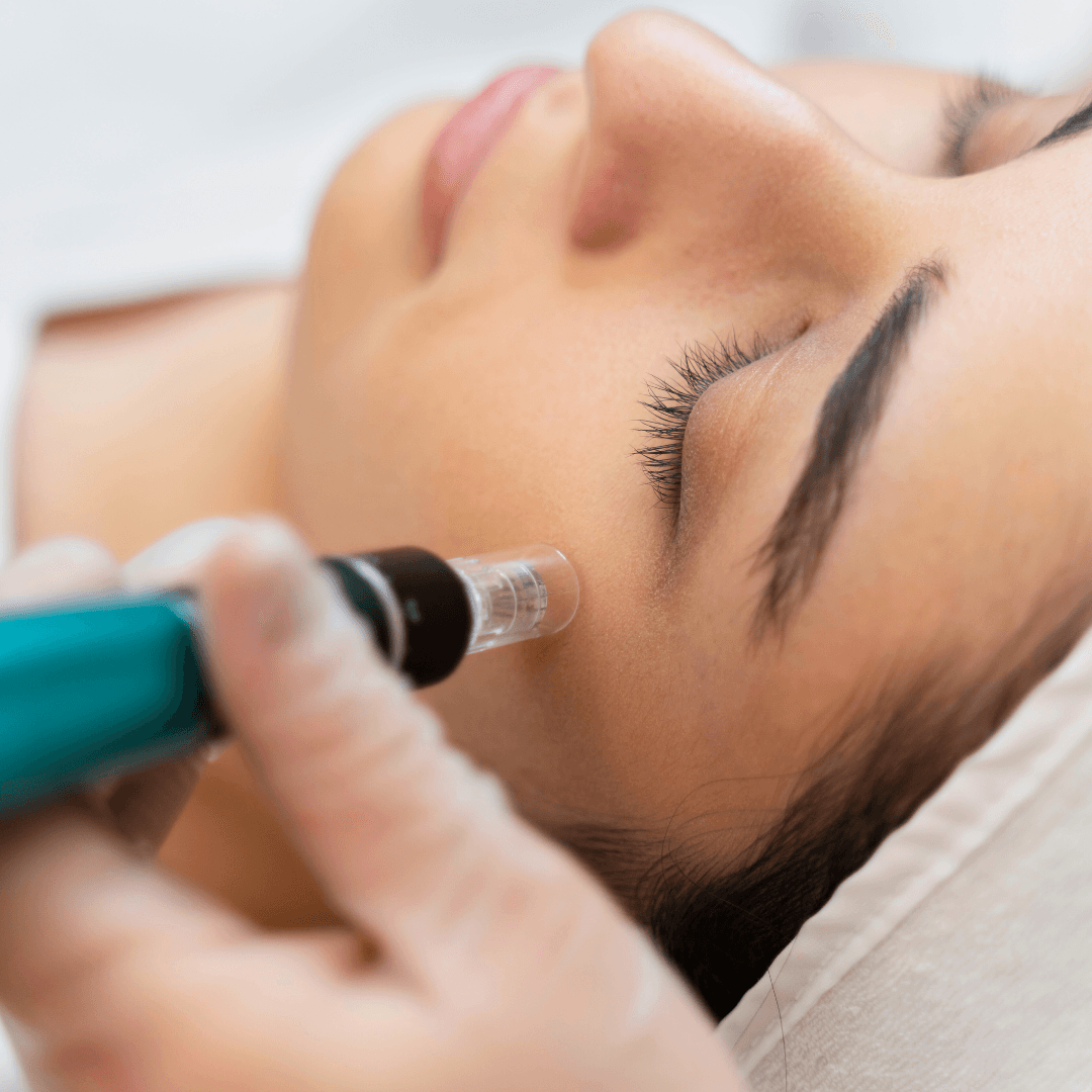 Hydrafacial Treatment