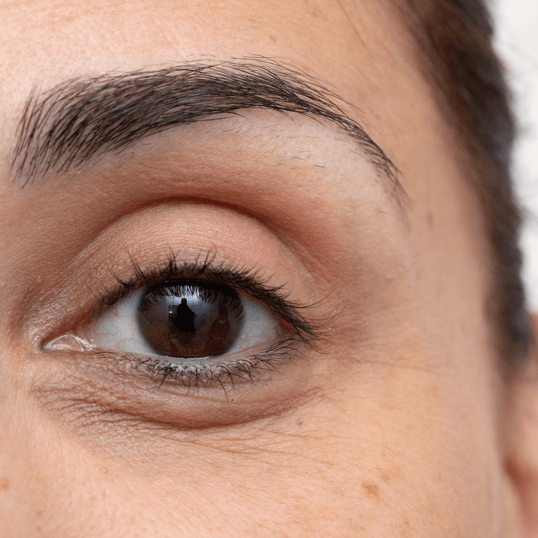 Dark Circle & Under Eye Treatment