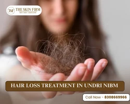 Hair loss treatment in Undri NIBM