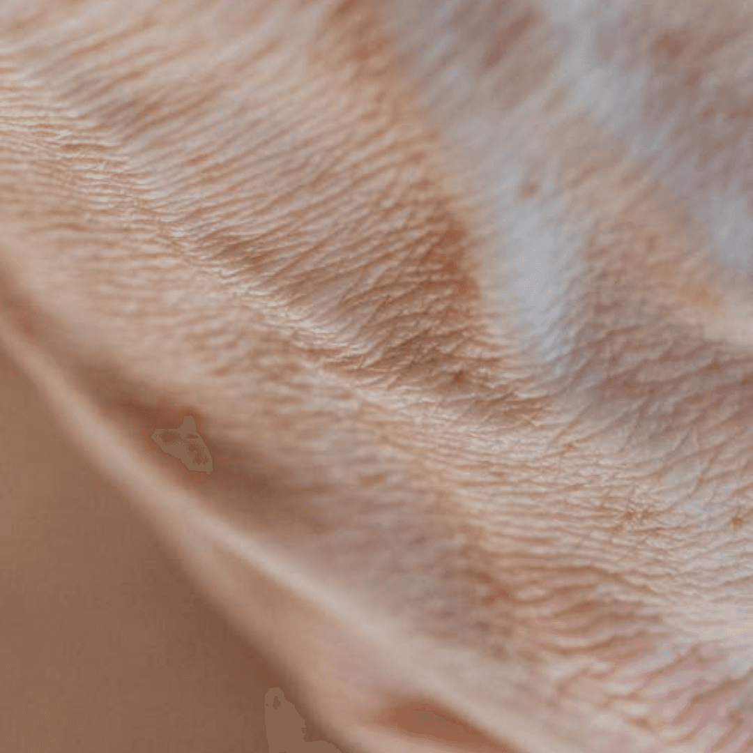 Wrinkle Treatment