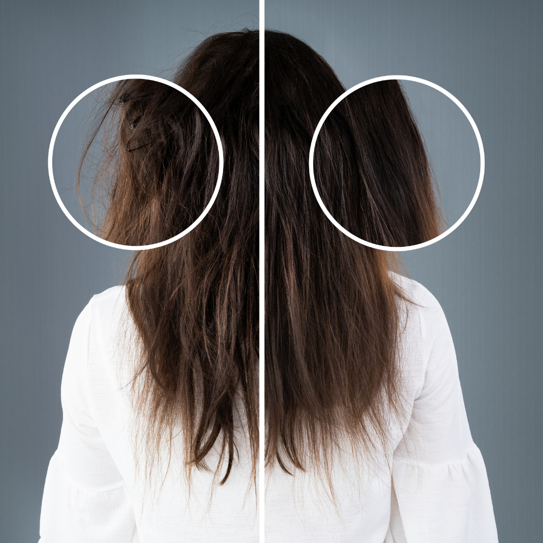 Hair Regrowth & Density Improvement